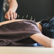 Acupuncture-treatment
